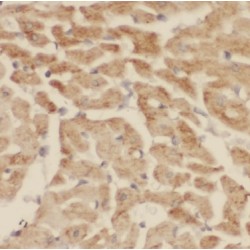 CCR4-NOT Transcription Complex Subunit 1 (CNOT1) Antibody