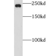 WB analysis of human brain tissue, using CNOT1 antibody (1/800 dilution).