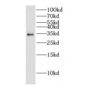 WB analysis of mouse testis tissue, using CNOT7 antibody (1/500 dilution).