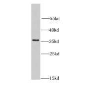 WB analysis of Jurkat cells, using CNOT8 antibody (1/1000 dilution).