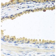 IHC-P analysis of human prostate tissue, using COCH antibody (1/100 dilution).