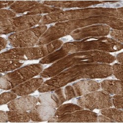 Cofilin 2 (CFL2) Antibody