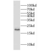 WB analysis of human liver tissue, using CFL2 antibody (1/400 dilution).