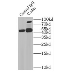 Coilin (COIL) Antibody