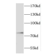 WB analysis of human brain tissue, using COIL antibody (1/800 dilution).