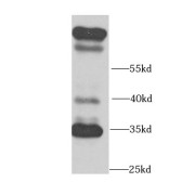 WB analysis of MCF7 cells, using COLEC11 antibody (1/1000 dilution).