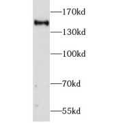 WB analysis of mouse brain tissue, using COL3A1 antibody (1/1000 dilution).