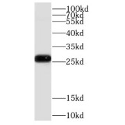 WB analysis of mouse kidney tissue, using COMMD5 antibody (1/1000 dilution).