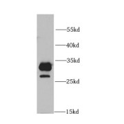 WB analysis of mouse liver tissue, using COMT antibody (1/1000 dilution).