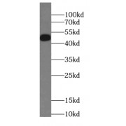 WB analysis of A431 cells, using Connexin-46 antibody (1/600 dilution).