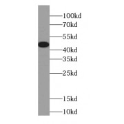 WB analysis of human brain tissue, using Connexin-46 antibody (1/200 dilution).