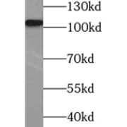 WB analysis of MCF7 cells, using COP1 antibody (1/1000 dilution).