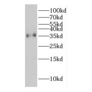 WB analysis of PC-3 cells, using COPE antibody (1/500 dilution).