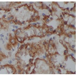 COP9 Signalosome Subunit 3 (COPS3) Antibody