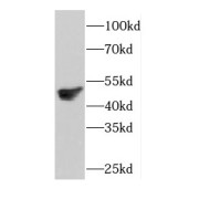 WB analysis of human brain tissue, using COPS3 antibody (1/500 dilution).