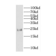 WB analysis of mouse brain tissue, using COPS8 antibody (1/600 dilution).