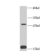 WB analysis of mouse liver tissue, using COQ7 antibody (1/1000 dilution).