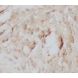 Cyclooxygenase-1 / COX-1 (PTGS1) Antibody