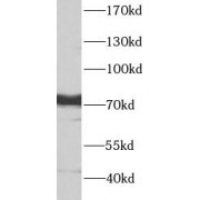 WB analysis of A549 cells, using PTGS1 antibody (1/500 dilution).