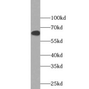 WB analysis of HEK-293 cells, using PTGS2 antibody (1/600 dilution).