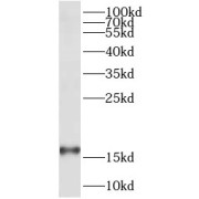 WB analysis of PC-3 cells, using FAM36A antibody (1/600 dilution).