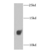 WB analysis of human brain tissue, using COX6A1 antibody (1/1000 dilution).