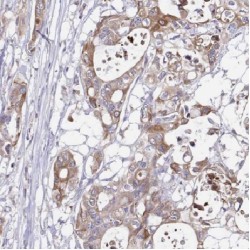 Cytochrome C Oxidase Subunit 6C (COX6C) Antibody