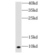 WB analysis of mouse heart tissue, using COX7A1 antibody (1/1000 dilution).