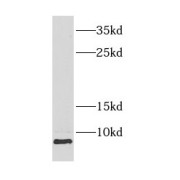 WB analysis of mouse skeletal muscle tissue, using COX8A antibody (1/2000 dilution).