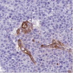 Carboxypeptidase B1 (CPB1) Antibody
