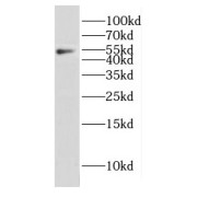 WB analysis of A375 cells, using CPEB1 antibody (1/1000 dilution).