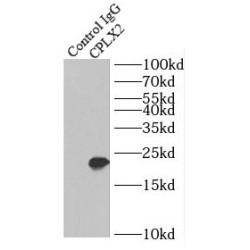 Complexin 2 (CPLX2) Antibody