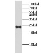 WB analysis of mouse brain tissue, using CPLX2 antibody (1/1000 dilution).