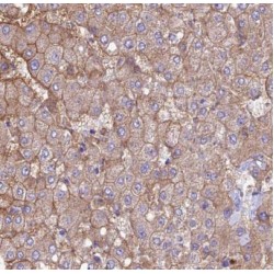 Carboxypeptidase N1 (CPN1) Antibody