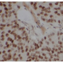 Copine-3 (CPNE3) Antibody