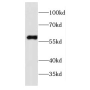 WB analysis of Y79 cells, using CPNE3 antibody (1/400 dilution).