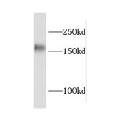 WB analysis of Jurkat cells, using CPSF1 antibody (1/500 dilution).