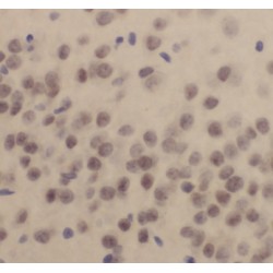 Cleavage And Polyadenylation Specificity Factor Subunit 2 (CPSF2) Antibody