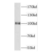 WB analysis of HeLa cells, using CPSF2 antibody (1/800 dilution).