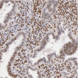 Cleavage And Polyadenylation Specificity Factor Subunit 4 (CPSF4) Antibody