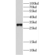 WB analysis of Jurkat cells, using CPSF4 antibody (1/300 dilution).