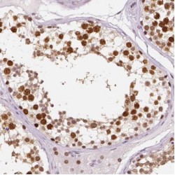 Cleavage And Polyadenylation Specificity Factor Subunit 7 (CPSF7) Antibody