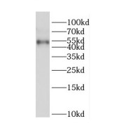 WB analysis of mouse brain tissue, using CPSF7 antibody (1/500 dilution).