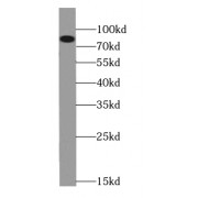 WB analysis of mouse heart tissue, using CPT1B-specific antibody (1/1000 dilution).