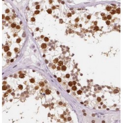 Carnitine O-Palmitoyltransferase 1, Brain Isoform (CPT1C) Antibody