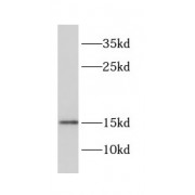 WB analysis of human spleen tissue, using CRABP1 antibody (1/500 dilution).