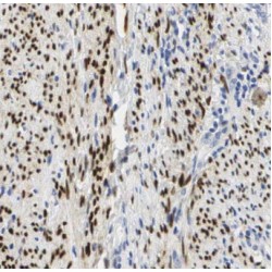 Protein Cereblon (CRBN) Antibody