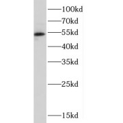 WB analysis of mouse heart tissue, using CRBN antibody (1/1000 dilution).