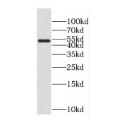 WB analysis of PC-3 cells, using CREB3 antibody (1/300 dilution).