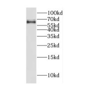 WB analysis of HepG2 cells, using CREB3L2 antibody (1/600 dilution).